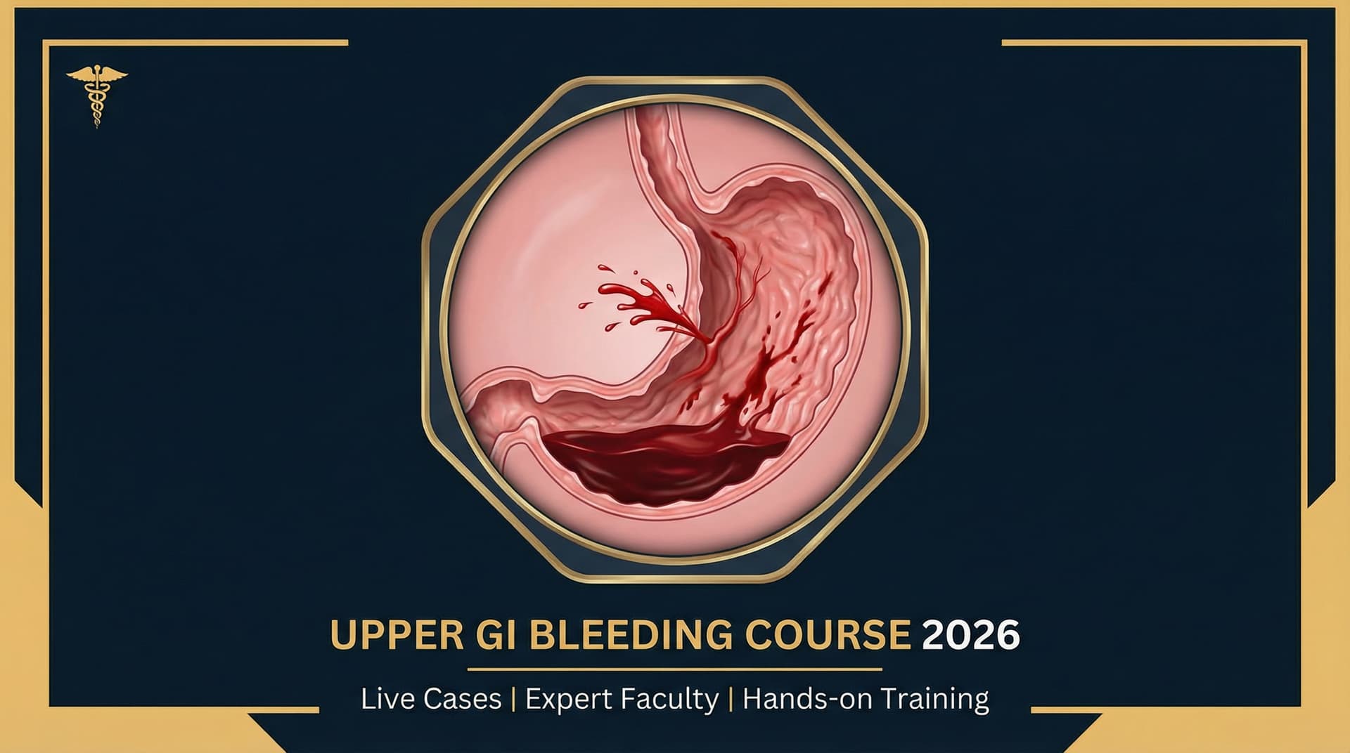 Upper GI Bleeding Masterclass | GIEQs Courses | GIEQs
