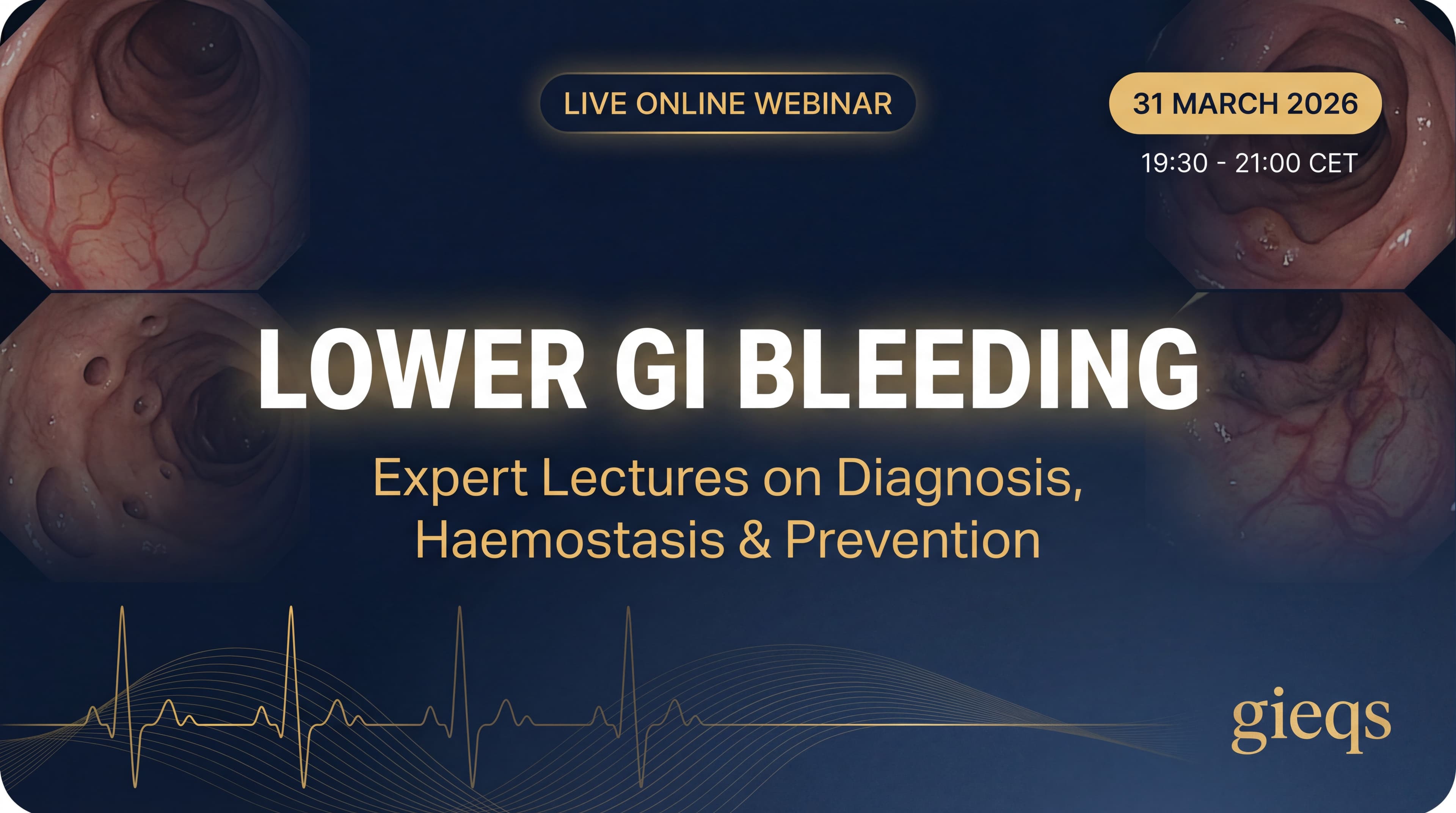 GIEQs Webinar: Lower GI Bleeding