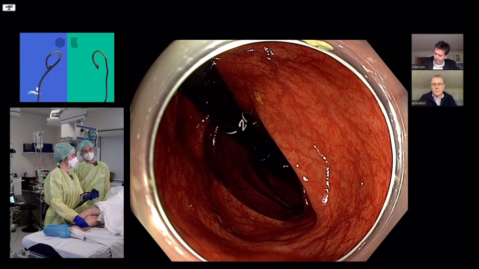 Colonoscopy Technique Upskilling Course