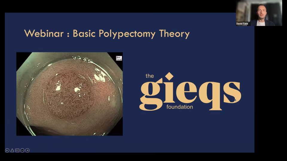 Webinar: Theoretical Basis of Polypectomy