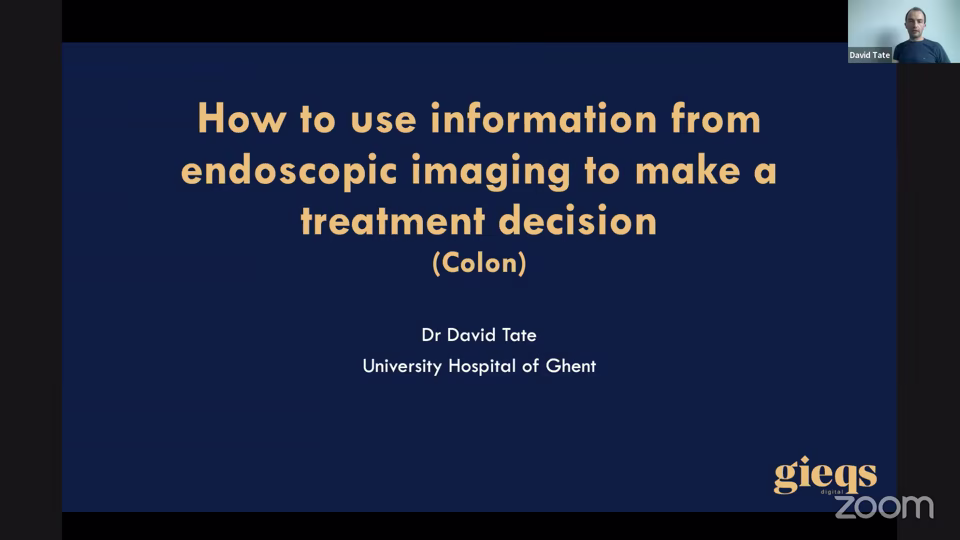 Endoscopic Imaging of Colorectal Polyps – ACPGBI Edition