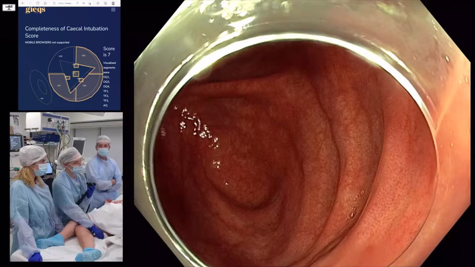 Starting out with Colonoscopy and Basic Polypectomy