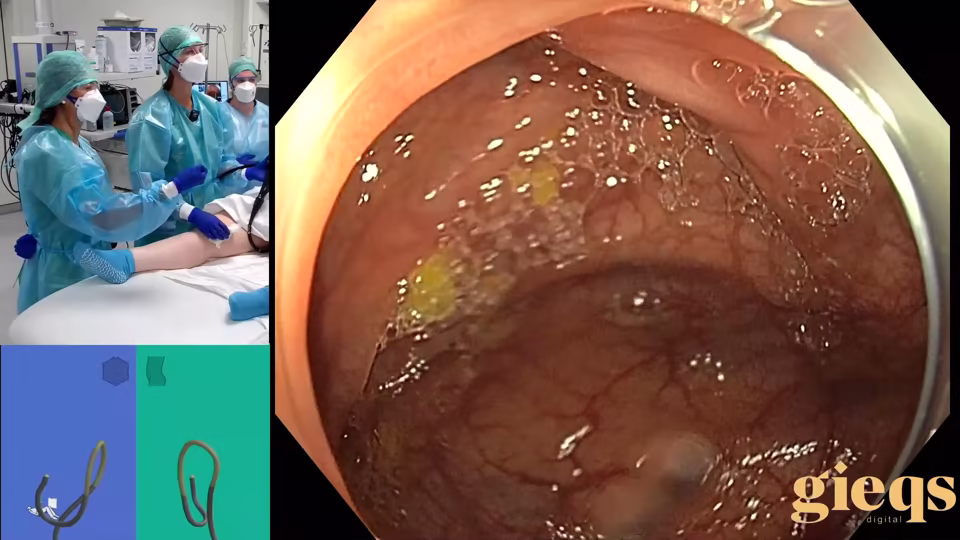 Train the Colonoscopy Trainers Course (Virtual / Live Hybrid)